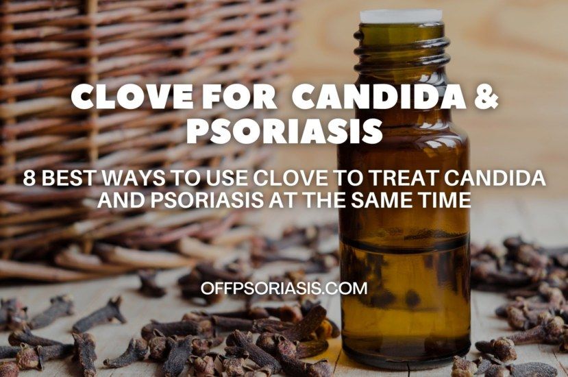 8 Best ways to use Clove to treat Candida and Psoriasis at the same time OffPsoriasis